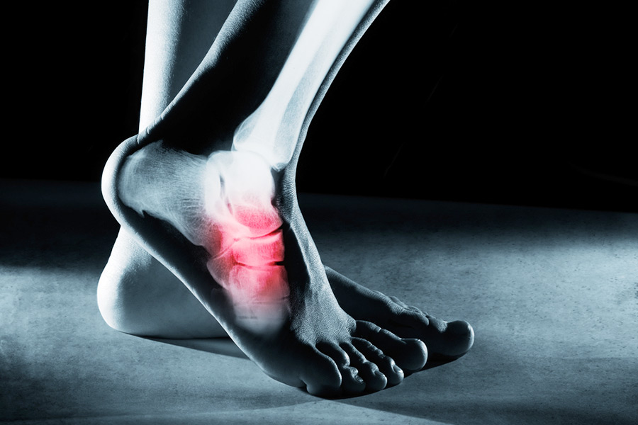 At Soleil Surgical, we value our patients time and we are proud to offer in-house foot and ankle radiographs.