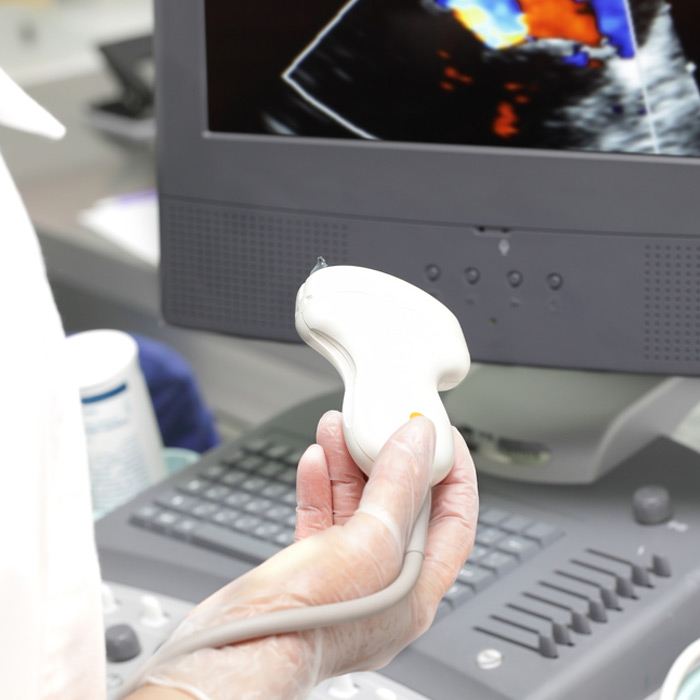 Arterial Doppler Ultrasound - Soleil Surgical