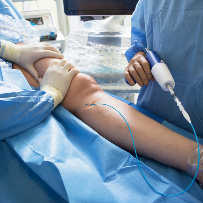 Aortoiliac Occlusive Disease - Soleil Surgical