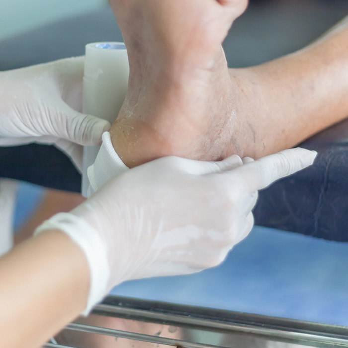 Diabetic Foot Care - Soleil Surgical
