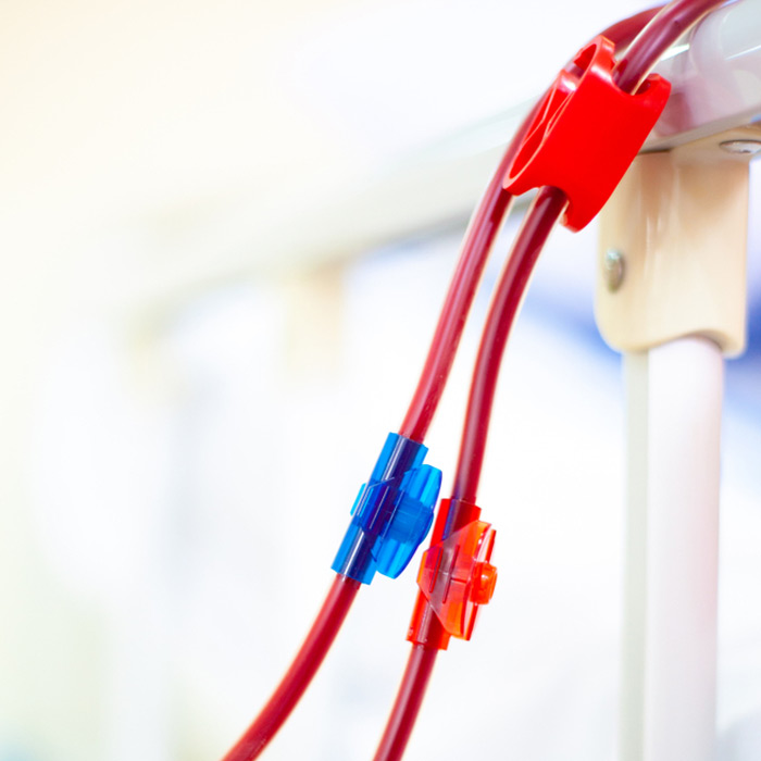 Dialysis Access Doppler - Soleil Surgical