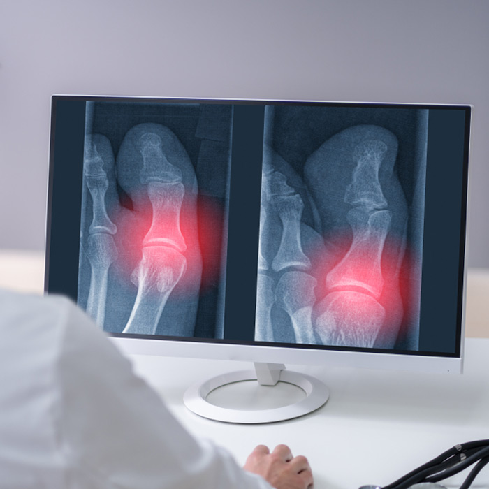 Digital X-Rays - Soleil Surgical