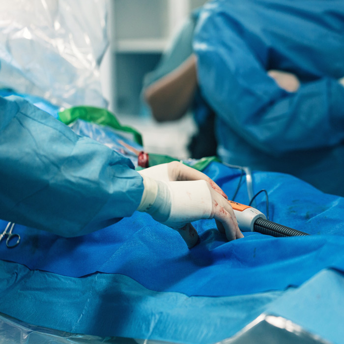 Chronic Venous Insufficiency - Soleil Surgical