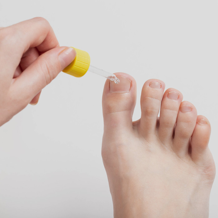 Nail Fungus Products - Soleil Surgical