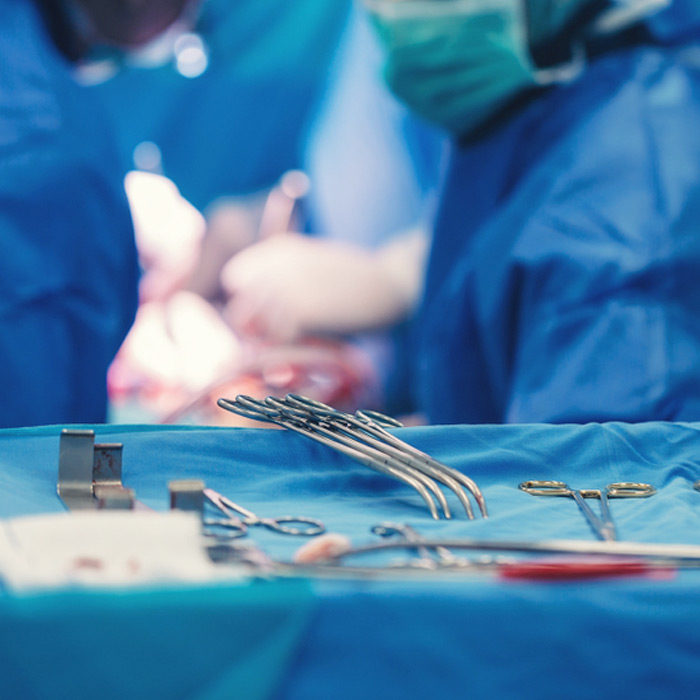 Endoleaks (Type I-V) - Soleil Surgical