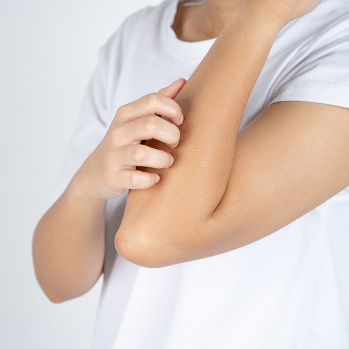 Skin Conditions - Soleil Surgical