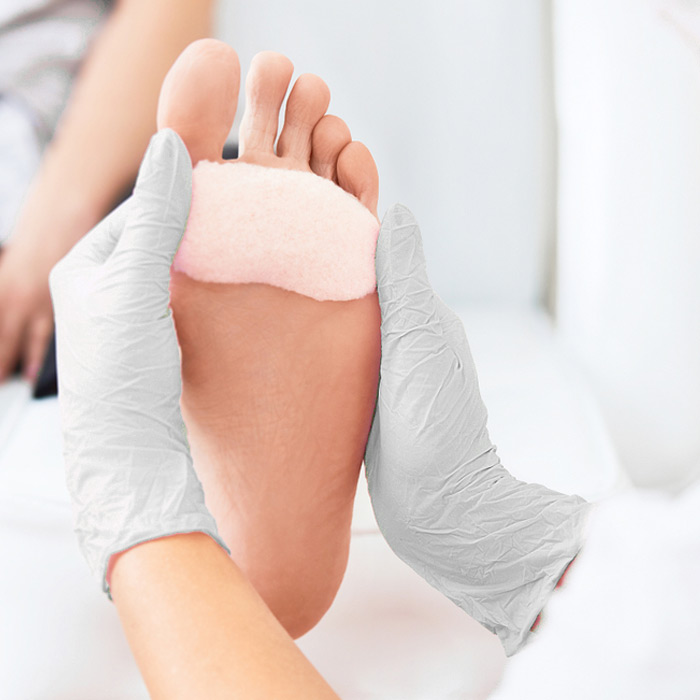 Ulcer Prevention - Soleil Surgical