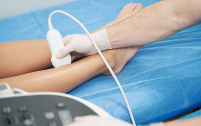 Habits or Situations that May Lead to Thrombosis