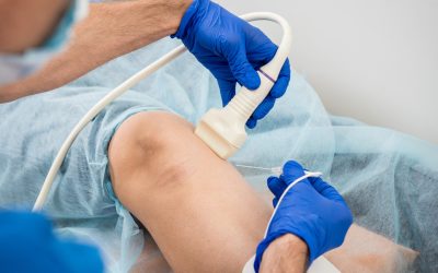 ¿Por qué son importantes los Ultrasonidos Vasculares?