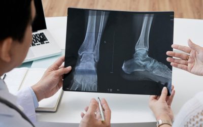 ¿Por qué es Importante Visitar a un Médico Podiatra?