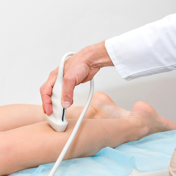 Duplex Ultrasound - Soleil Surgical