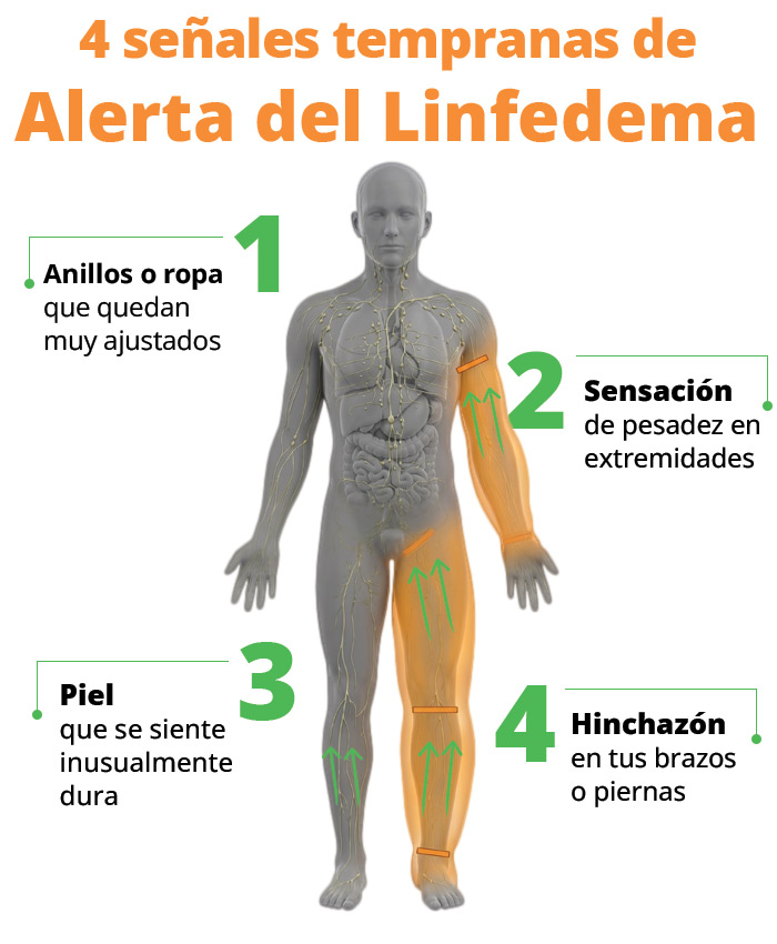 4 señales tempranas de alerta del linfedema